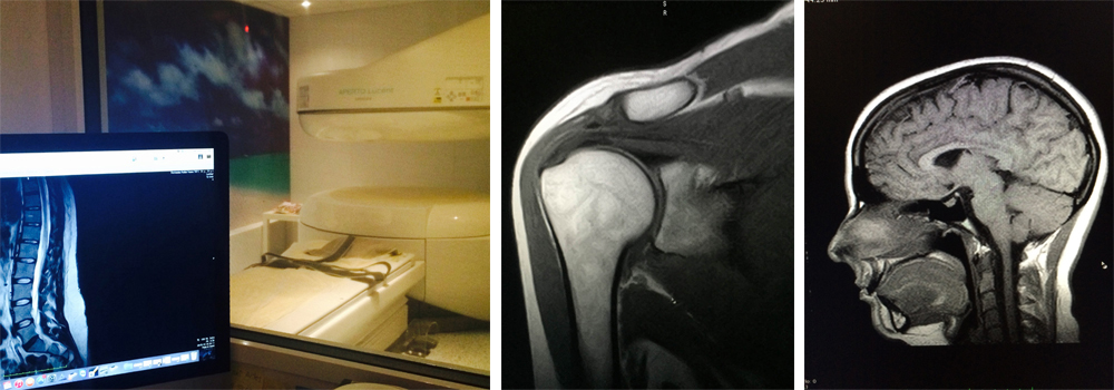resonancia magnetica5